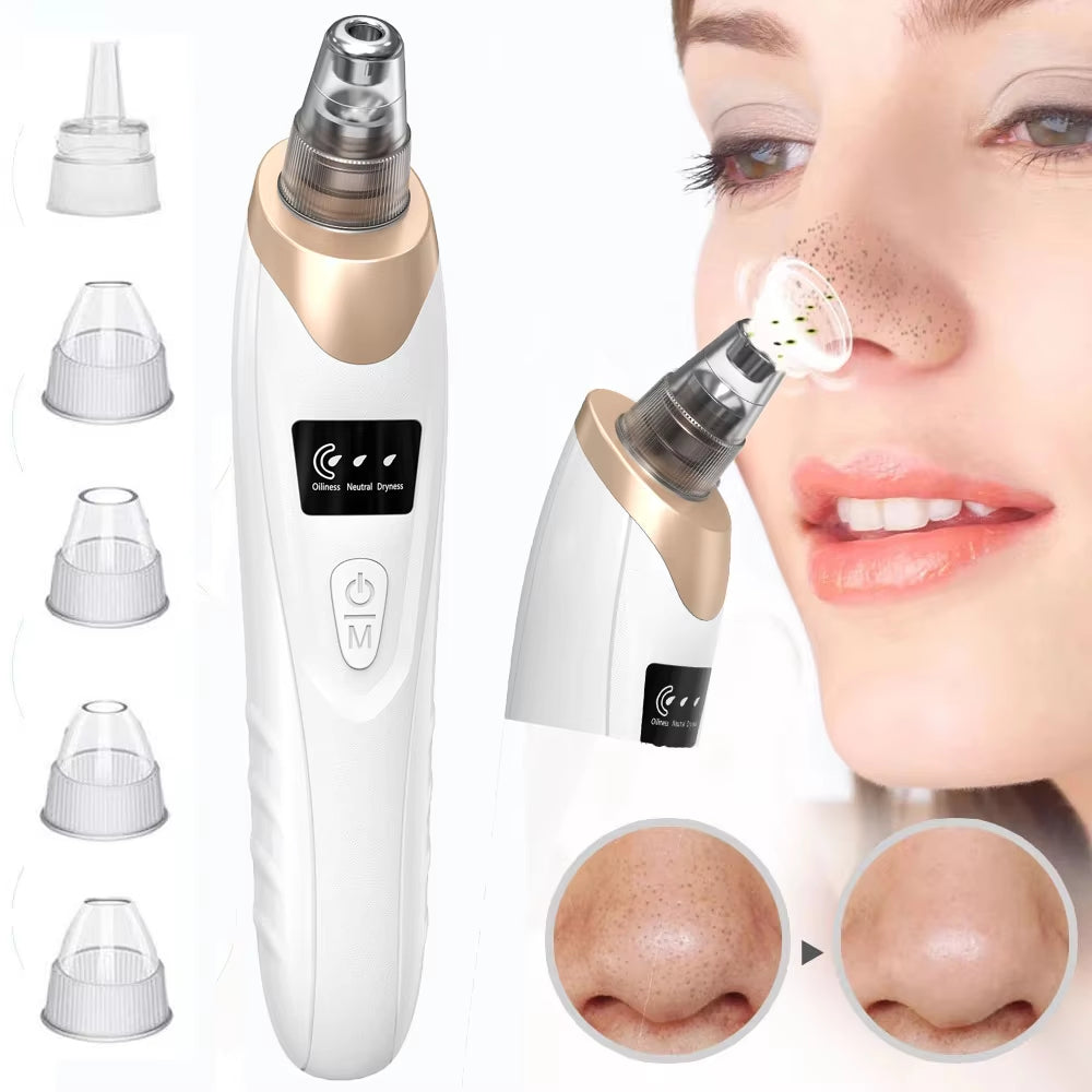 Vacuum Blackhead Remover Kit